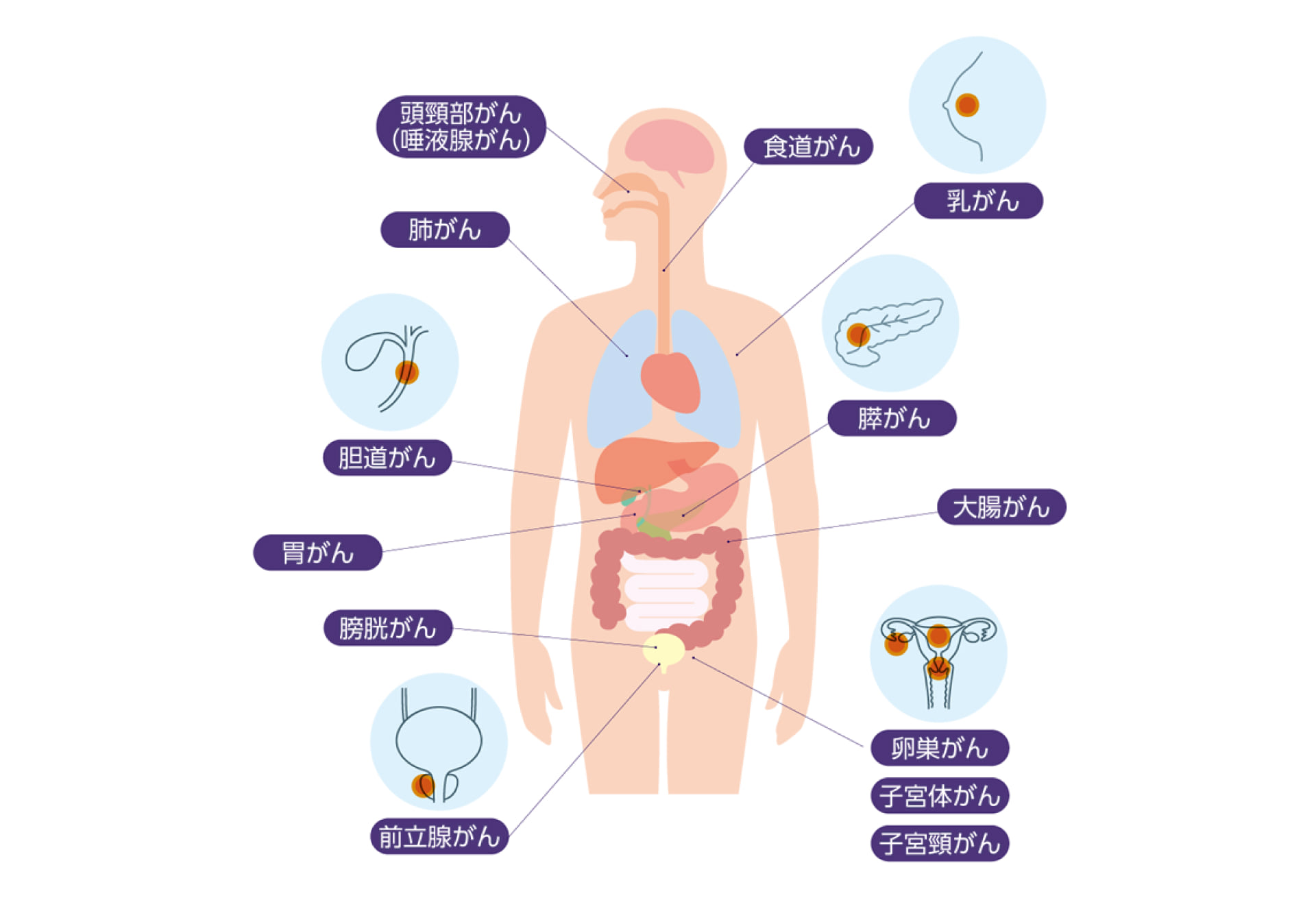頭頸部・肺・食道・乳房・胆道・胃・膵臓・大腸・膀胱・前立腺・卵巣・子宮のがんを示す人体図