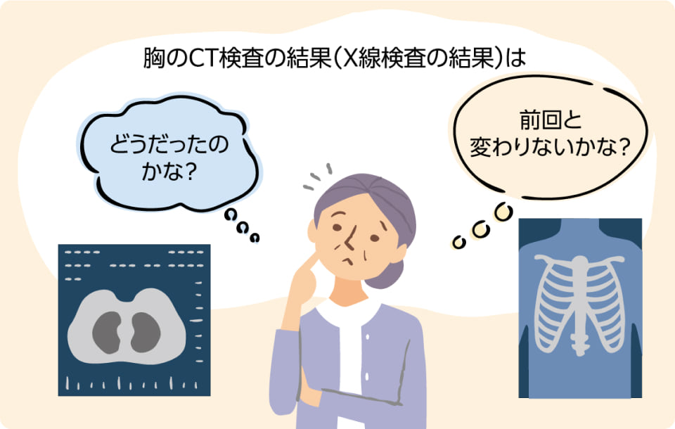 胸のCT検査やX線検査の結果が前回と変わりないか気にしている患者さんのイラスト。